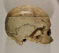 skull, side view